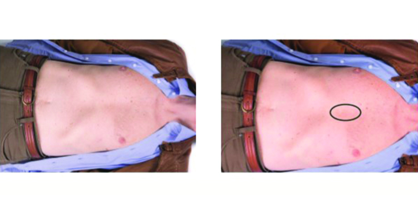 Це рятує життя. Як правильно робити серцево-легеневу реанімацію: корисна інструкція